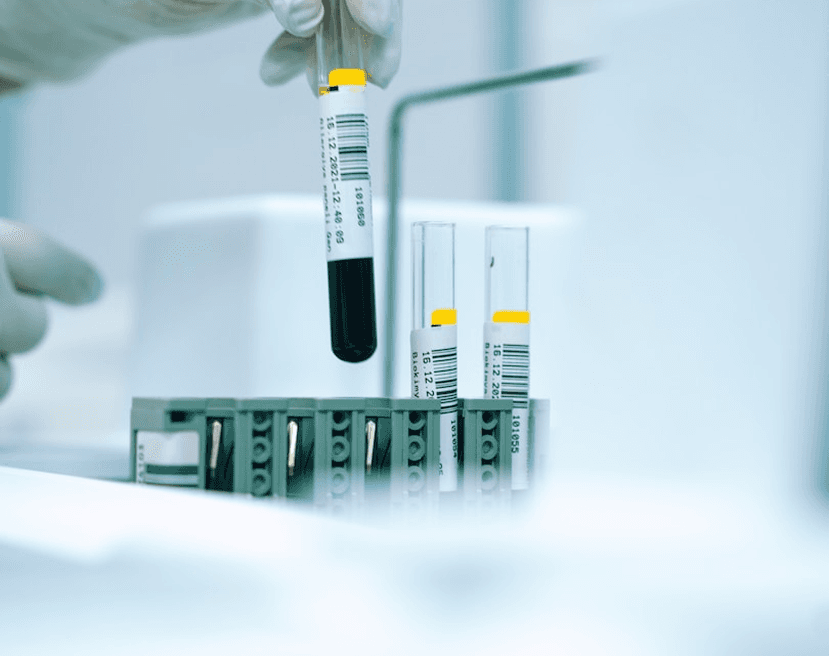 Laboratorijski uzorci